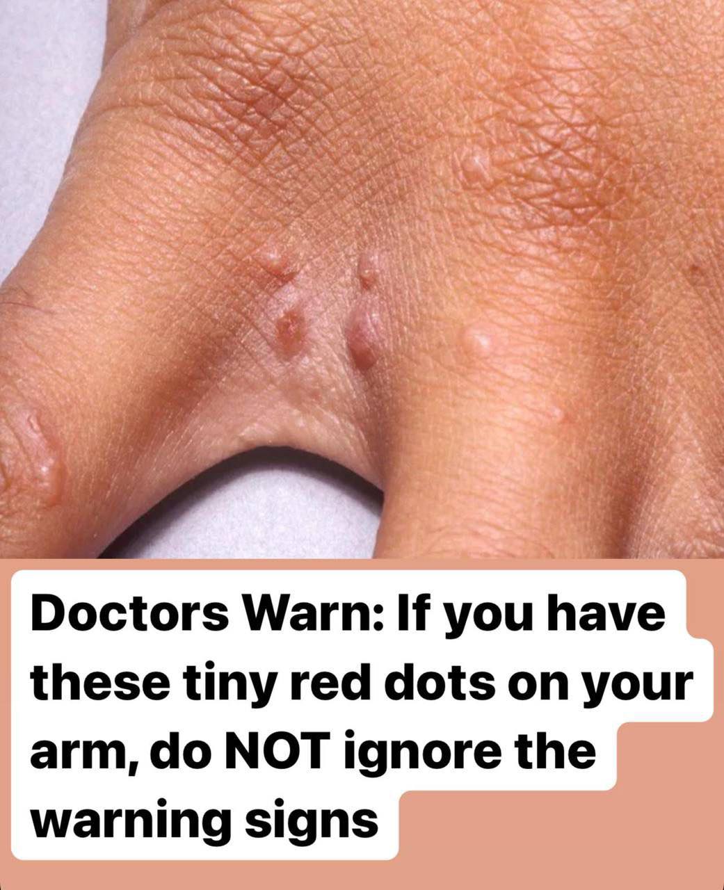 If You Have These Tiny Red Dots On Your Arm, Do Not Ignore The Warning Signs