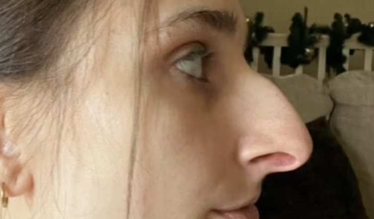 I spent 10 grand on a nose job… I can’t believe how much it has changed my life