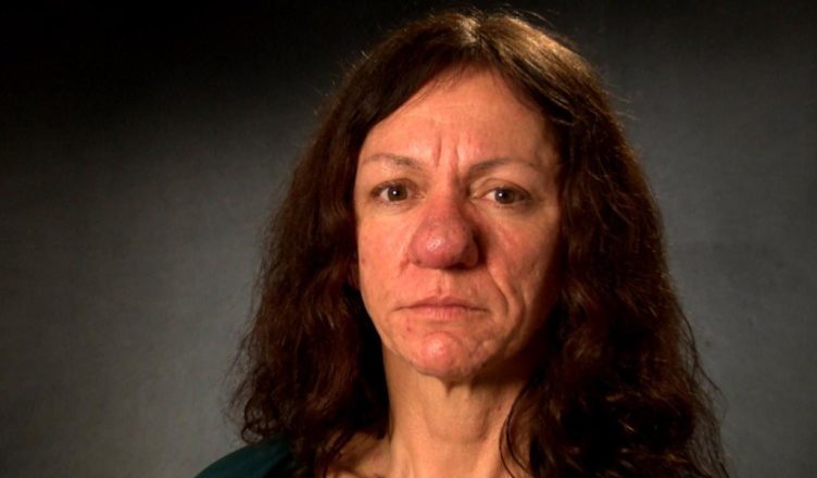 This 30-Year-Old Woman Got a Nose Job and Looks Unrecognizable After… Photos Here!