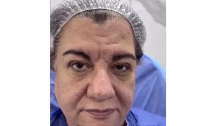 She Was 68 and Tired of Looking in the Mirror—What She Did Next Shocked Everyone… Results Here!