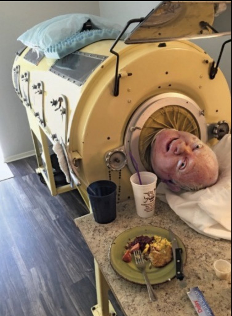 76-year-old man, paralyzed from polio at 6, was one of the last people with an iron lung: ‘My life is incredible’
