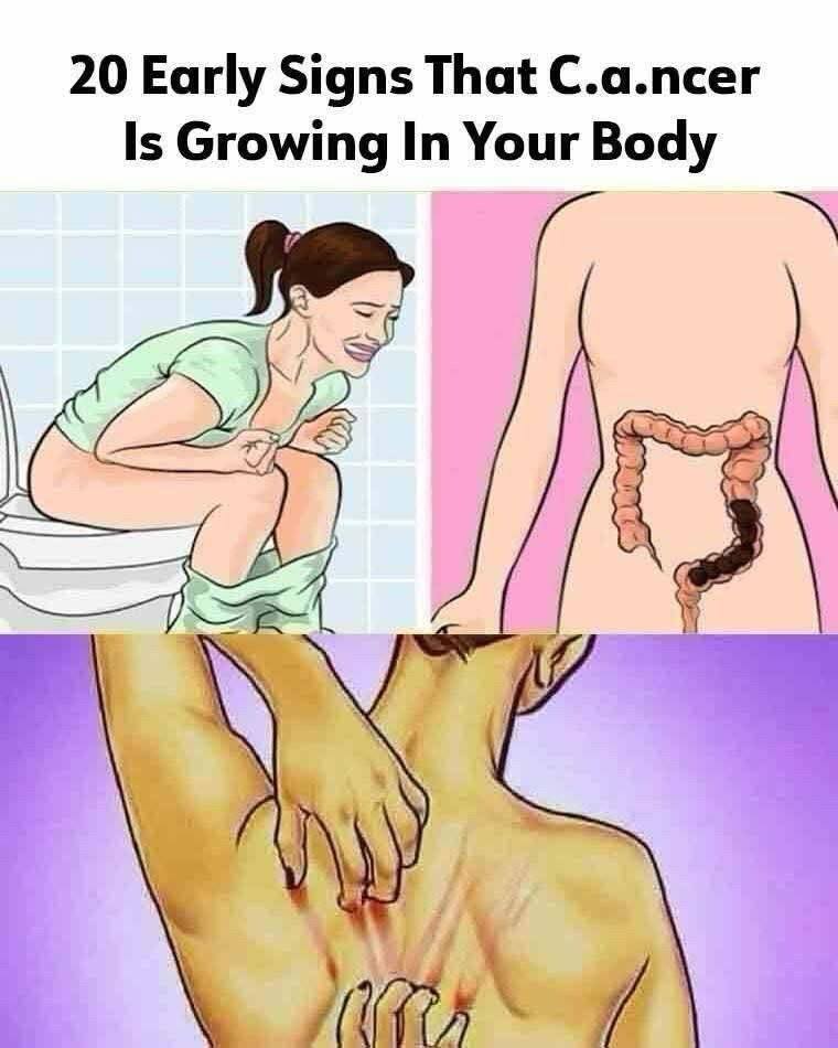 20 Early Warning Signs of Cancer You Should Never Ignore