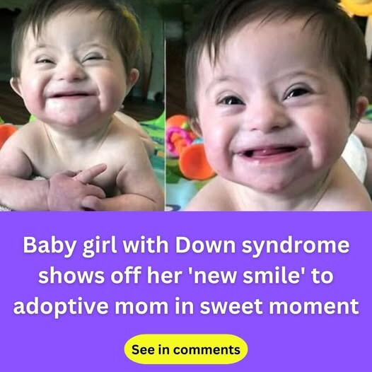 Adopted Baby with Down Syndrome Captures Hearts Online After Smiling at Mom