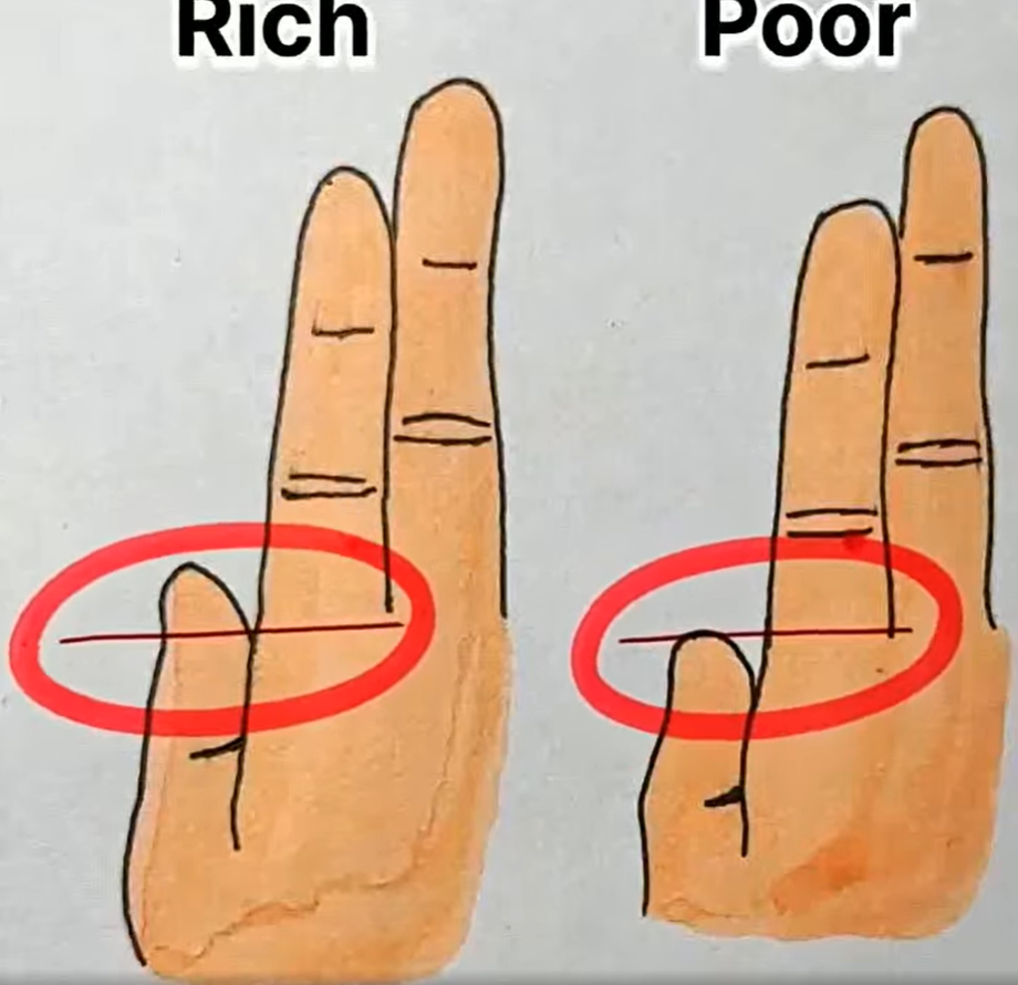 Your Fingers Could Reveal Whether You’re Rich or Poor