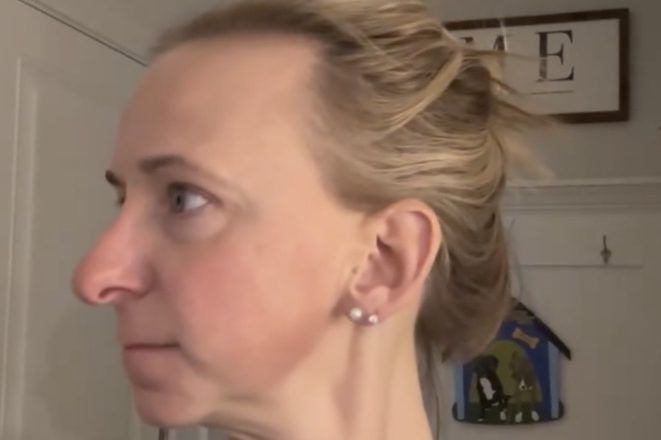 She Transformed Her Face at 45—You Won’t Believe What She Looks Like Now…