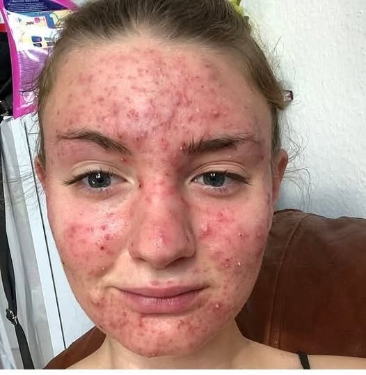 His body was itchy, he thought it was an allergy