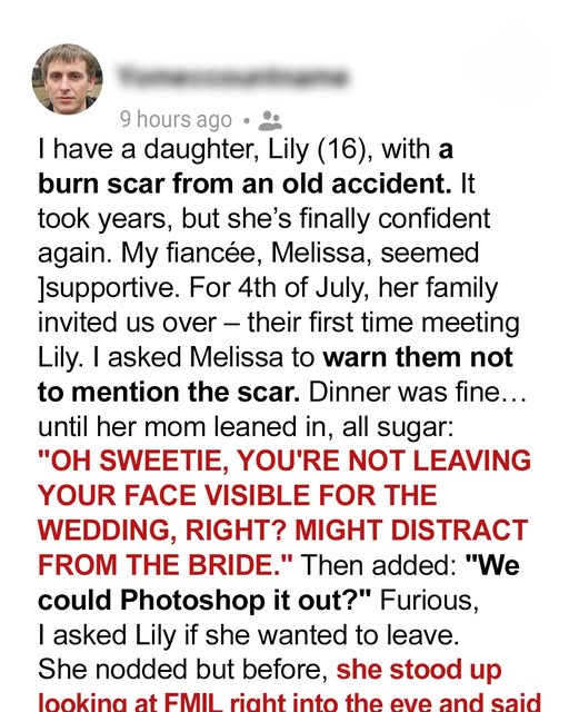 My Fiances Mom Suggested Editing My Daughters Scar Out of the Wedding Pics, Her Comeback Made Everyone Choke