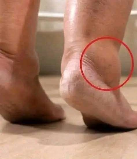 These are the signs that he is cr…See more