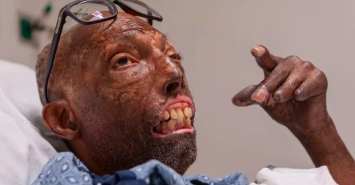 He Refused a New Face That Didn’t Look Like Him — And Waited Until the Right One Changed His Life Forever