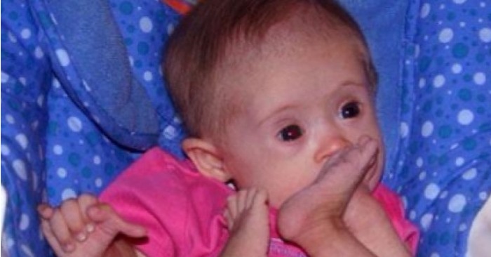 Doctors Told Her to Expect the Worst – But This Mom’s Love Helped Her Daughter With Down Syndrome Beat Every Odd