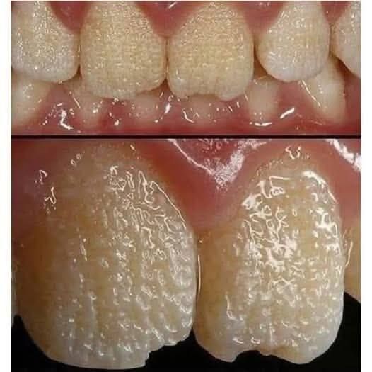 PP21. Be careful!! This is what your teeth will become when you eat…