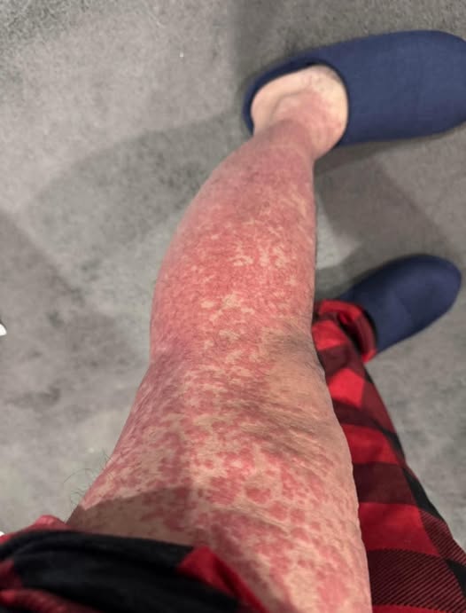 These are the consequences of sleeping with…
