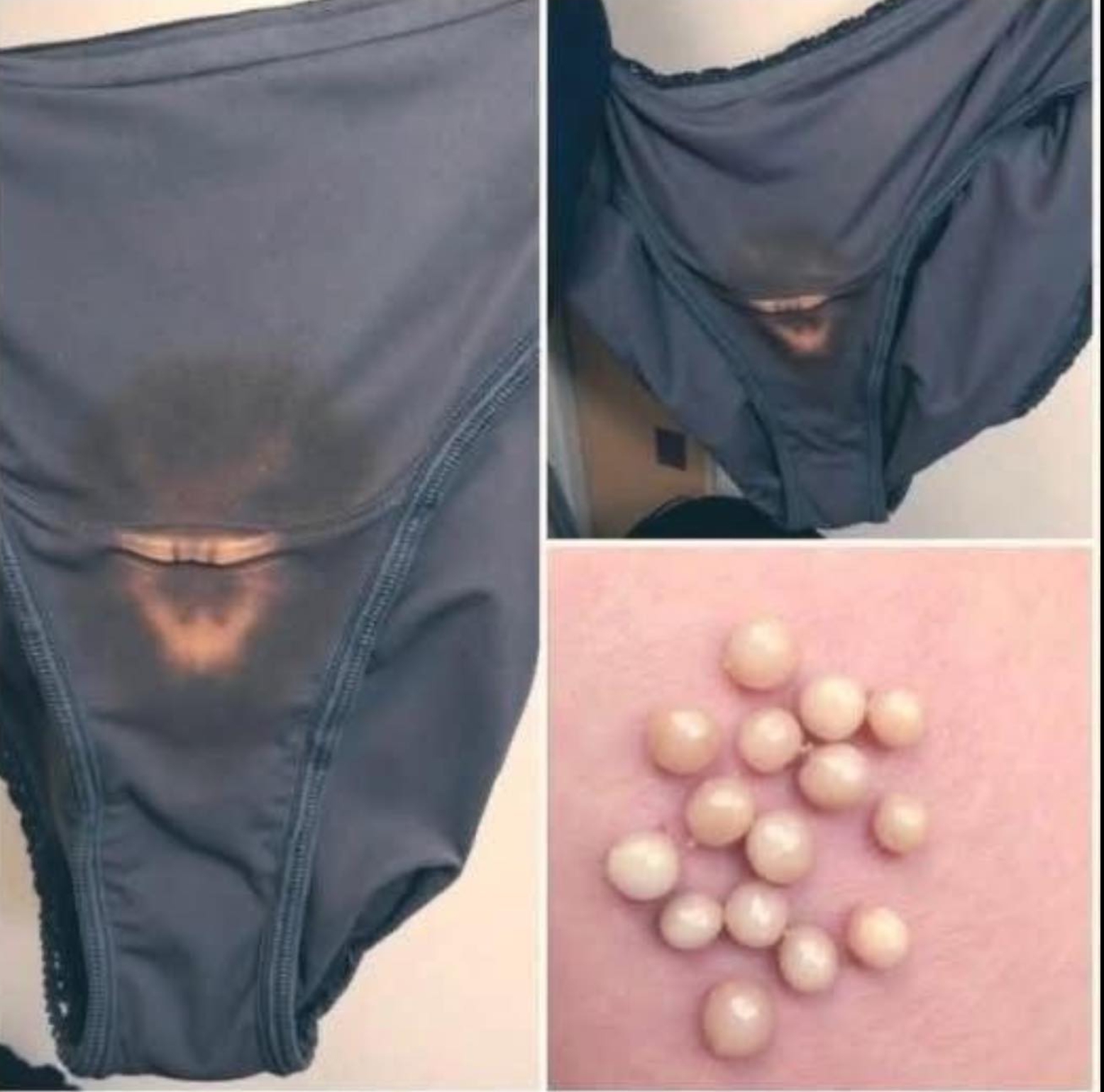 BE CAREFUL, if you notice this in your underwear, it means you have!!