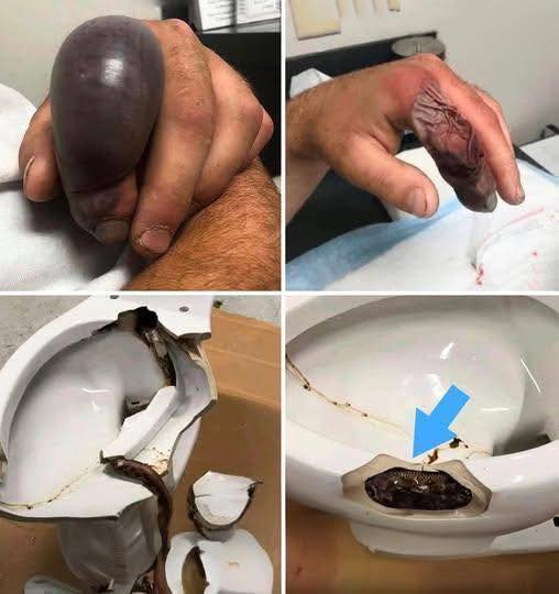 In several regions, while using their toilets, people were attacked