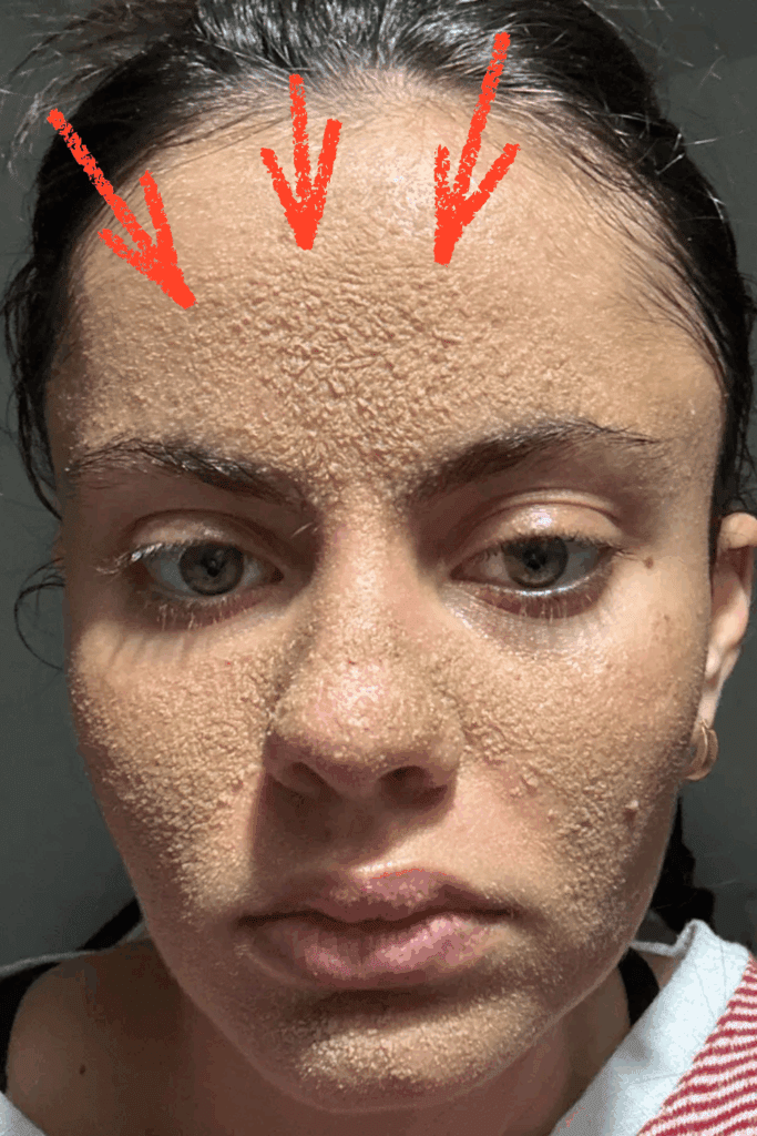 That Was Real Surprising! 22-Year-Old Stuns Everyone by Admitting She Never Cleanss Her Face