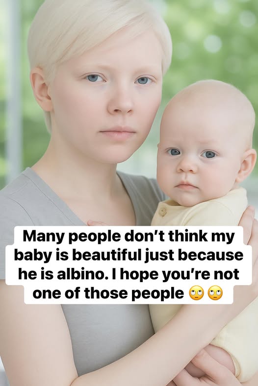 The Child Who Changed Hearts: A Mother’s Journey Through Love, Strength, and Acceptance