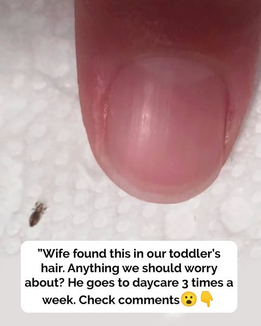 Found a Tiny Bug in Your Hair? Read This First
