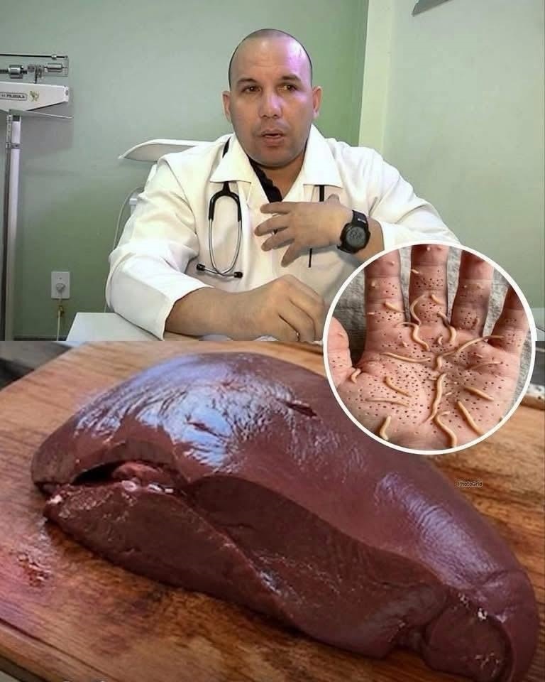 What Eating Beef Liver Too Often Can Do to Your Body