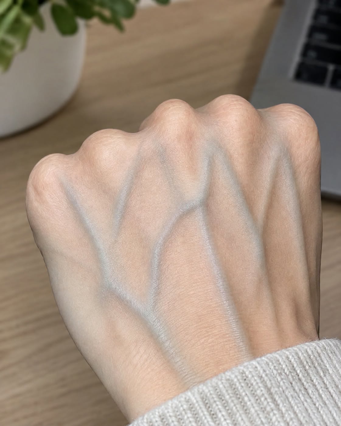If you have visible veins, it means you are….