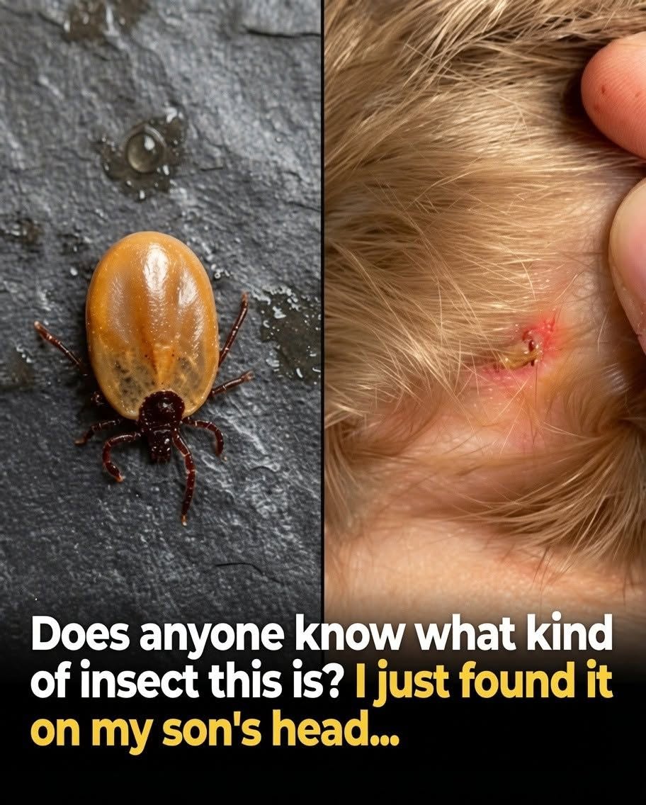 I Found This Tick Attached to My Son’s Head — and It Was a Wake-Up Call