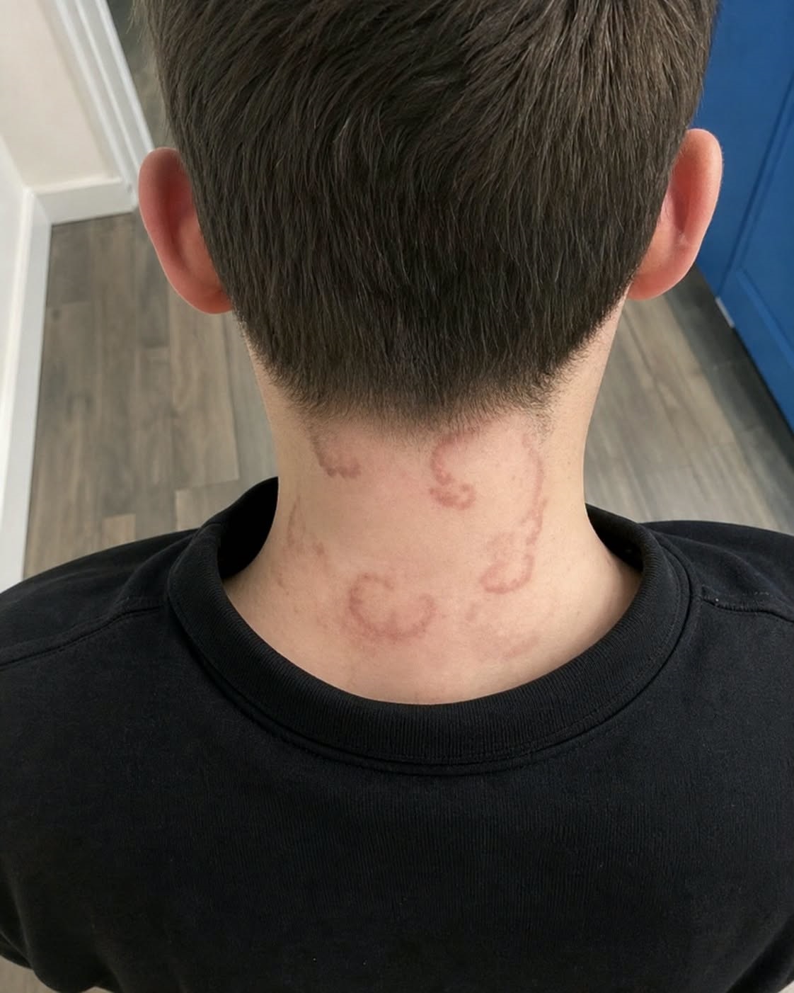 The Marks He Couldn’t Explain