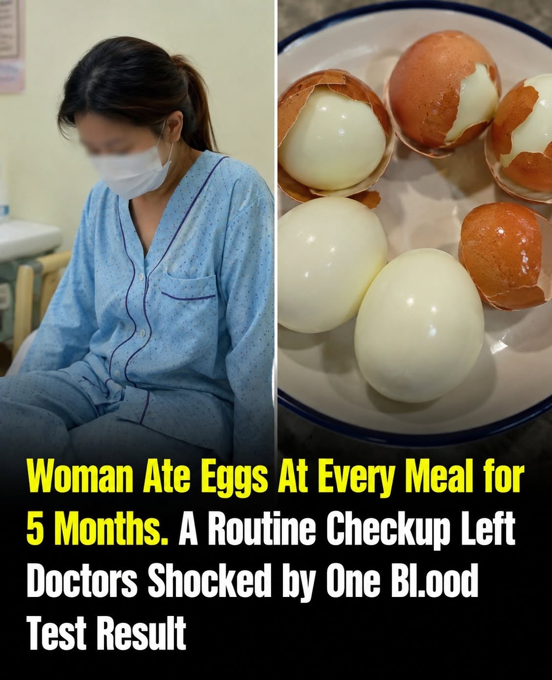 Woman Ate Eggs at Every Meal for Five Months — A Routine Checkup Revealed an Unexpected Result