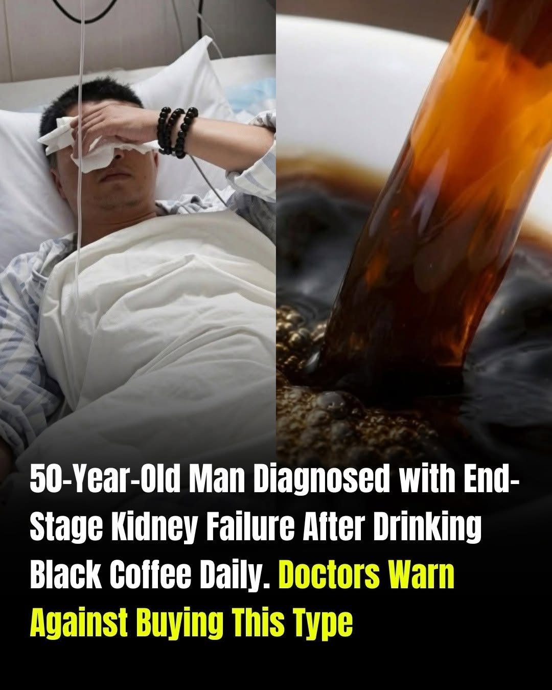 Black Coffee and Kidney Health: Understanding the Facts About Your Daily Coffee Habit