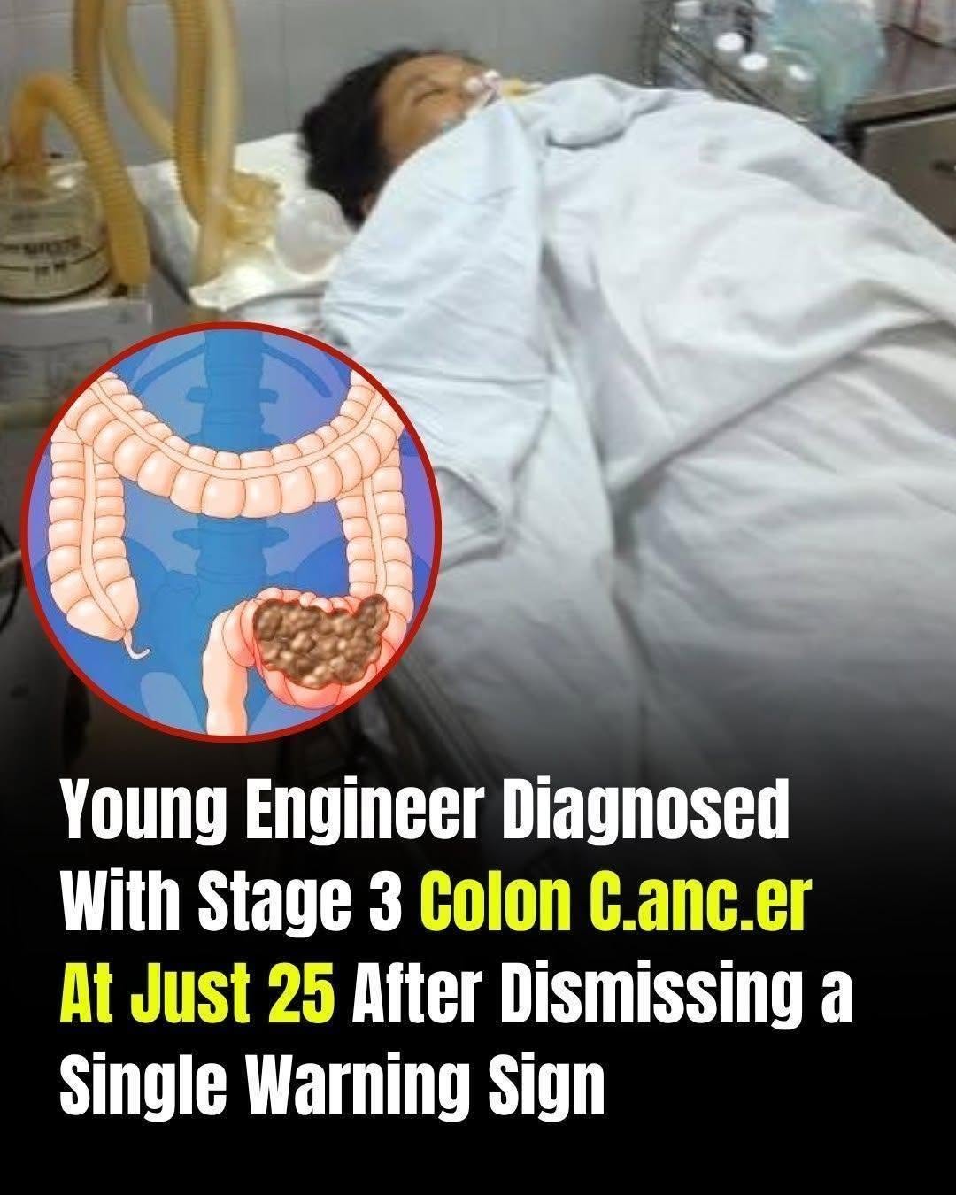 Young Engineer Diagnosed With Stage 3 Colon Can.cer at 25 After Ignoring One Warning Sign