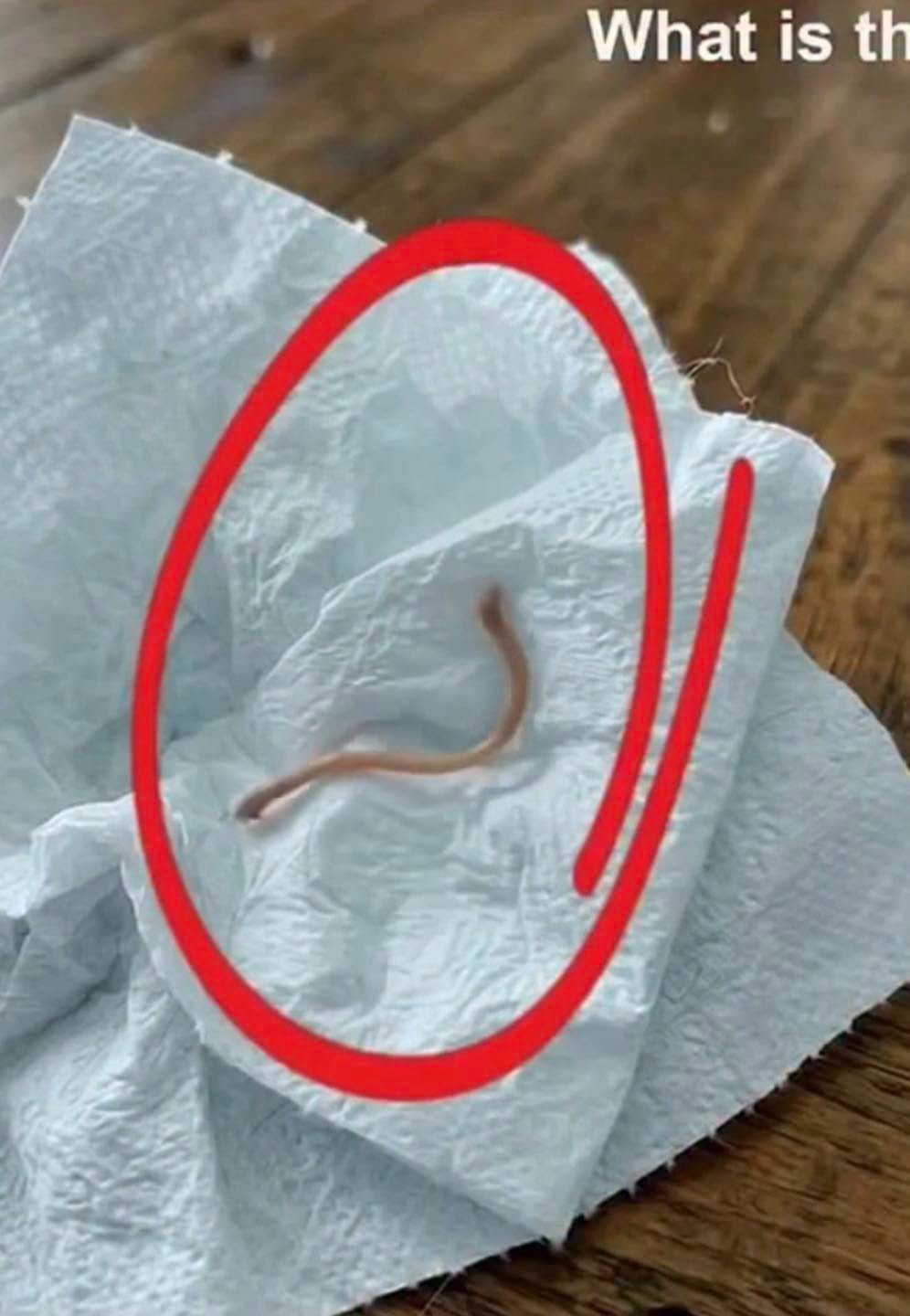I went to the store to buy pork ribs and came home to cook them. I started frying them in a pan, and after a while, I suddenly noticed this on the meat. I carefully picked it up and placed it on a paper towel. Honestly, I immediately lost my appetite. I started examining it closely, trying to understand what it was, but with no success. Does anyone know what this is? Check the first comment for the answer
