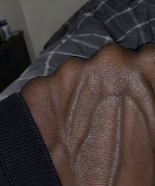 Why the Veins on Your Hands May Look More Noticeable—and What It Can Mean